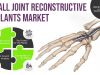 Why will Small Joint Reconstructive Implants Market Surge Rapidly in Asia-Pacific in Future?