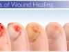 Wound Healing Market Size, Key Players, Industry Growth Analysis and Forecast to 2027