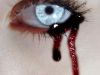 Tears of blood