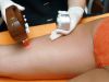 What to Do Before an Electrolysis Hair Removal Procedure