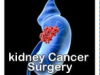 Understand Kidney Cancer &ndash; Causes And Surgery in India