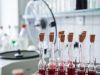 Detecting the Invisible Threat: The Growing Role of Blood Culture Tests in Modern Medicine