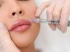 Hyaluronic Acid Based Dermal Fillers Market | Global Opportunity, Growth Analysis And Outlook Report