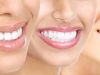 All about Dental Braces Lowell, MA