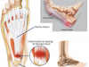 Plantar Fasciitis Relief: Effective Management Tips from ADAPT Recharge