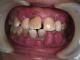 Dental Troglodyte 