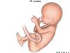 "Fetal Dwarfism"