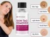 Cryogen Skin Tag Remover Reviews