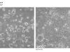 Caco-2 Cell Permeability Assay