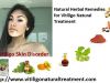Vitiligo Natural Treatment, Anti Vitiligo Herbal Treatment &amp;Cure