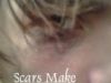 Scars Make Good Memories(Rough Draft)