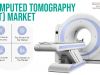 What Are Key Trends in Computed Tomography Market?