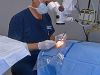 Cataract Surgery in India at Eye Surgery Hospitals of Delhi and Mumbai