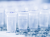Custom Assays Market  Research Study Including Growth Factors, Types And Application By Regions From