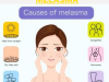 An Overview of Melasma