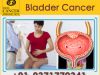 Bladder Cancer treatment in India with numerous facilities 
