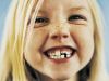Letter from a Once Gap-toothed Girl