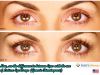 Use Latisse Eye Drops to possess appealing eyes with long and dark Eyelashes