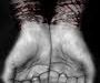 Ballad of Comatose