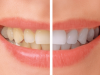 How does Dentist in Three Rivers work against tooth problems?