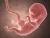 Fetal Times