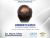 Androgenetic Alopecia Treatment 