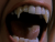 Vampire Breath