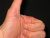 NO THUMBS