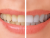 How does Dentist in Three Rivers work against tooth problems?