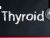 Thyroid RFA: A Safe and Effective Alternative to Surgery