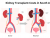 Kidney Transplant Costs in South Africa: Treatment Expenses, Medical Care, and Patient Support